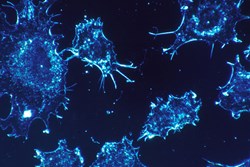 Combination Immunotherapy: Finding the Right Sequence and Timing
