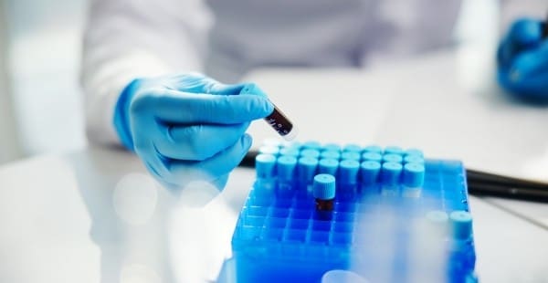 Gloved medical professional holding a blood sample for mesothelioma testing beside other vials in a rack