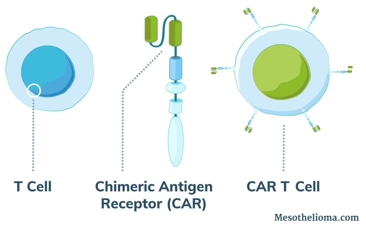 Mesothelioma CAR-T Cell Therapy