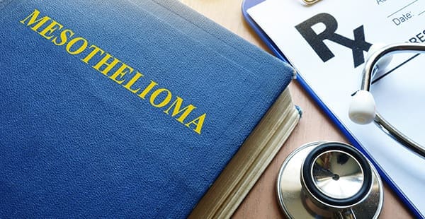 Misconceptions about mesothelioma