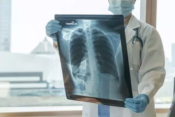 Focal radiation for progressive mesothelioma