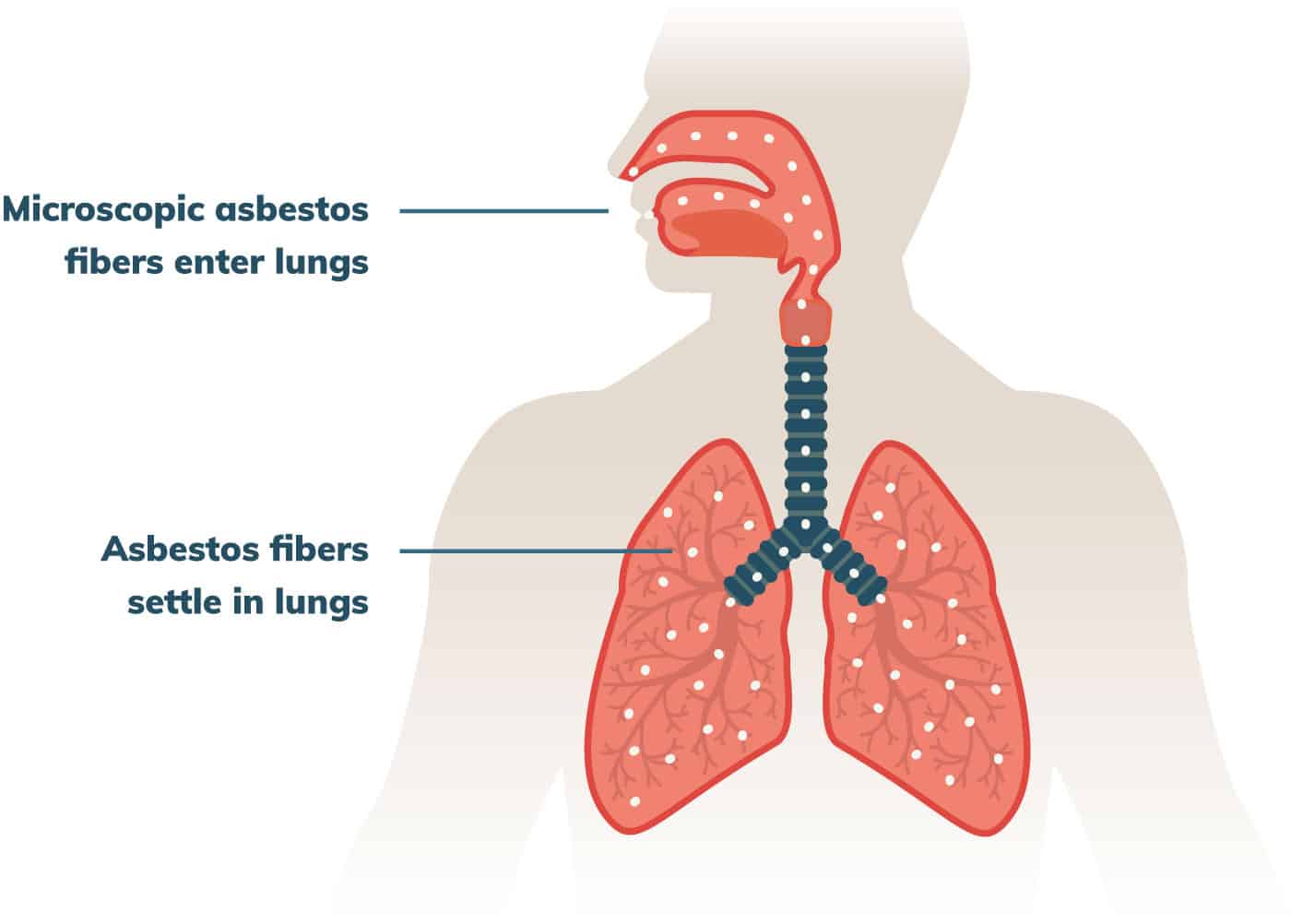 what color ribbon is neuroblastoma