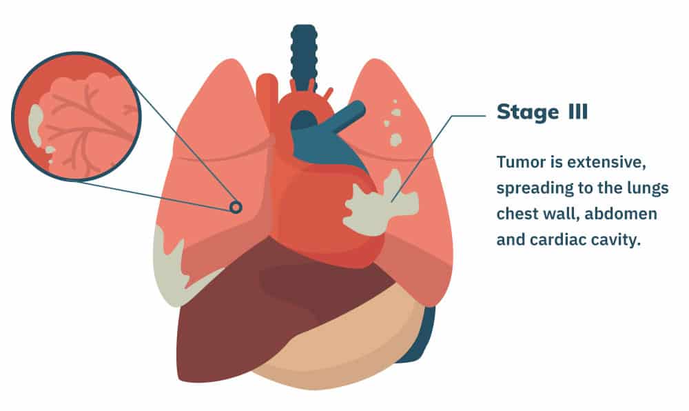 would copd show on chest x ray