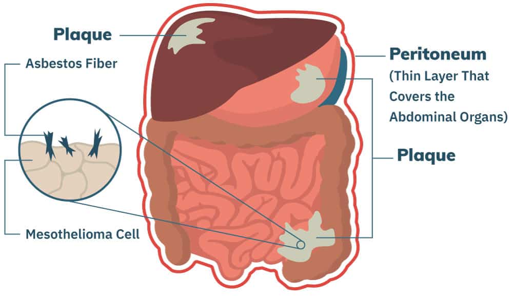 can you have covid 19 without lung issues