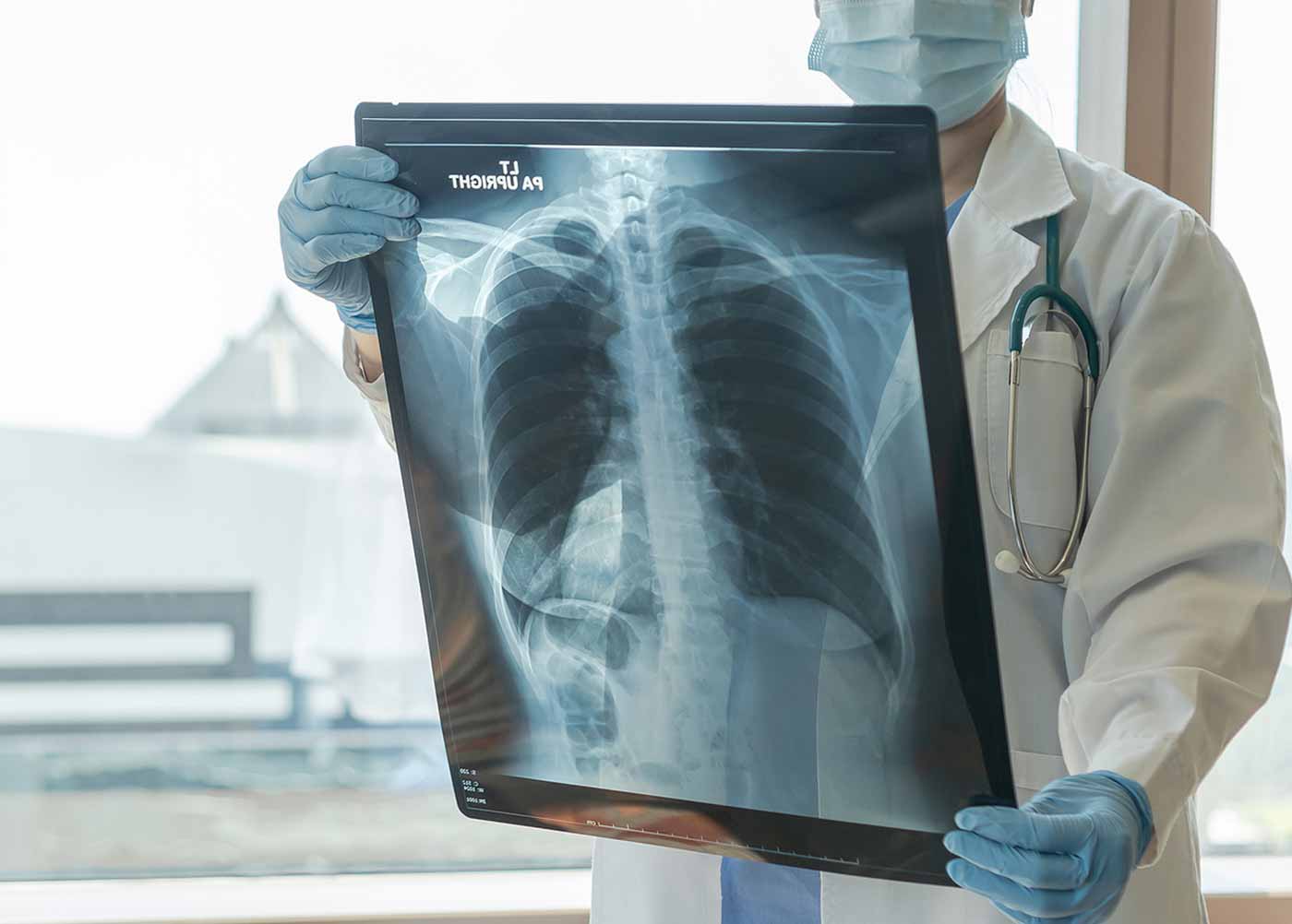 mesothelioma lawyers san diego