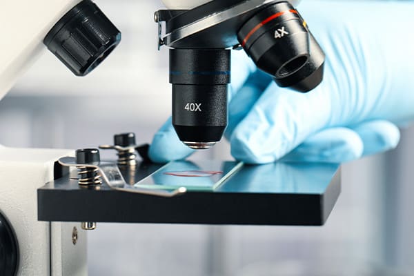 The gloved hand of a researcher places a slide onto the viewing stage of a microscope. The slide contains tissue from a peritoneal mesothelioma tumor.