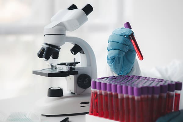 In the foreground, a mesothelioma researcher's gloved hand places a test tube back into a large rack full of similar test tubes. In the background, A microscope sits on the same laboratory benchtop as the test tubes. This setup parallels some of the tests that help researchers identify drugs that do or do not work for mesothelioma.