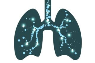 Air in the Pleural Cavity for Early Mesothelioma Detection