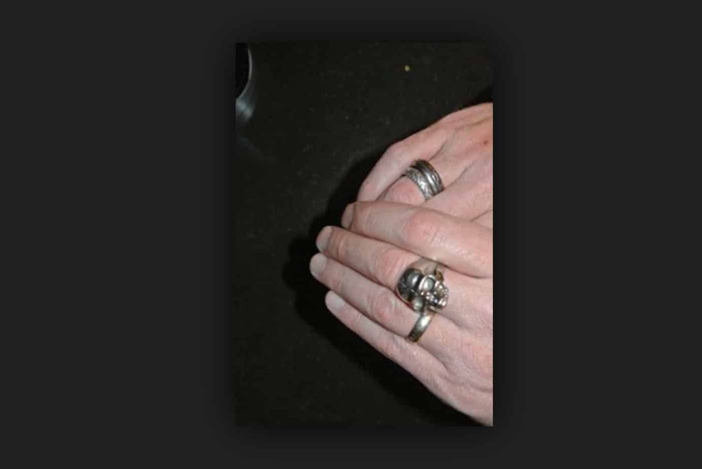 Mesothelioma caregiver Cameron Von St. James' skull ring